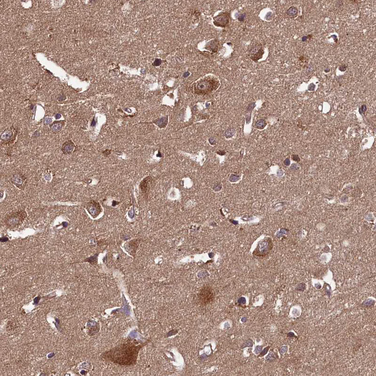 Immunohistochemistry (Formalin/PFA-fixed paraffin-embedded sections) - Anti-DOHH antibody (AB254866)