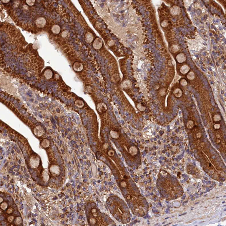 Immunohistochemistry (Formalin/PFA-fixed paraffin-embedded sections) - Anti-DOHH antibody (AB254866)