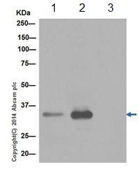 Immunoprecipitation - Anti-DOHH antibody [EPR16730] - BSA and Azide free (AB240975)