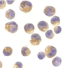 Immunocytochemistry/ Immunofluorescence - Anti-DOK1 antibody (AB8112)