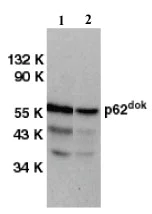Western blot - Anti-DOK1 antibody (AB8112)