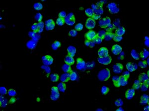 Immunocytochemistry/ Immunofluorescence - Anti-DOK1 antibody [EPR3228(2)] - BSA and Azide free (AB249202), expandable thumbnail