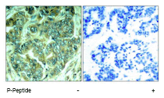 Immunohistochemistry (Formalin/PFA-fixed paraffin-embedded sections) - Anti-DOK1 (phospho Y398) antibody (AB75741)