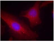 Immunocytochemistry/ Immunofluorescence - Anti-DOK2 antibody (AB131488)