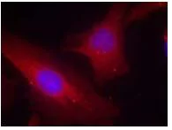 Immunocytochemistry/ Immunofluorescence - Anti-DOK2 antibody (AB131488)