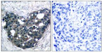 Immunohistochemistry (Formalin/PFA-fixed paraffin-embedded sections) - Anti-DOK2 antibody (AB131488)