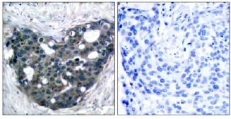 Immunohistochemistry (Formalin/PFA-fixed paraffin-embedded sections) - Anti-DOK2 antibody (AB131488)