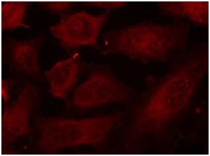 Immunocytochemistry/ Immunofluorescence - Anti-DOK2 (phospho Y299) antibody (AB131461)
