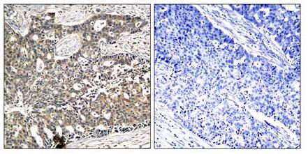 Immunohistochemistry (Formalin/PFA-fixed paraffin-embedded sections) - Anti-DOK2 (phospho Y299) antibody (AB131461)