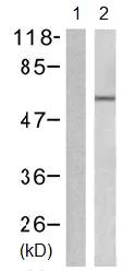 Western blot - Anti-DOK2 (phospho Y299) antibody (AB131461)