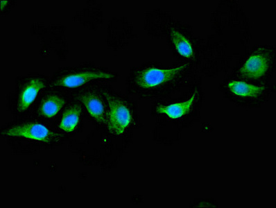 Immunocytochemistry/ Immunofluorescence - Anti-DOK3 antibody (AB236609), expandable thumbnail