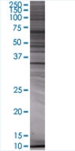 DOK3 overexpression 293T lysate (whole cell)