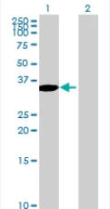 Western blot - DOK3 overexpression 293T lysate (whole cell) (AB94169)