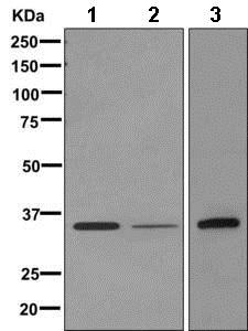 Western blot - Anti-DOK5 antibody [EPR9923(B)] (AB168343), expandable thumbnail