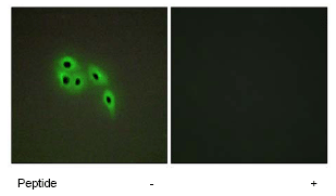 Immunocytochemistry/ Immunofluorescence - Anti-DOK6 antibody (AB72730)