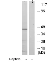 Western blot - Anti-DOK6 antibody (AB72730)
