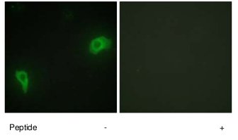 Immunocytochemistry/ Immunofluorescence - Anti-DOK7 antibody (AB75049)