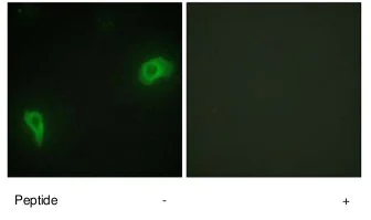 Immunocytochemistry/ Immunofluorescence - Anti-DOK7 antibody (AB75049)