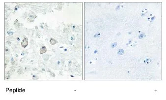 Immunohistochemistry (Formalin/PFA-fixed paraffin-embedded sections) - Anti-DOK7 antibody (AB75049)