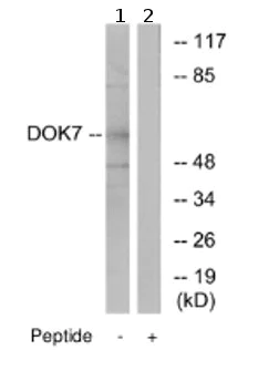 Western blot - Anti-DOK7 antibody (AB75049)