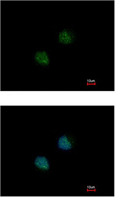 Immunocytochemistry/ Immunofluorescence - Anti-DOM3Z antibody (AB152135), expandable thumbnail