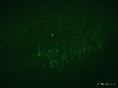 Immunohistochemistry (Formalin/PFA-fixed paraffin-embedded sections) - Donkey Anti-Chicken IgY H&L (FITC) (AB63507)