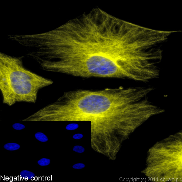 Immunocytochemistry/ Immunofluorescence - Donkey F(ab')2 Anti-Rat IgG H&L (Alexa Fluor® 555) preadsorbed (AB150150), expandable thumbnail