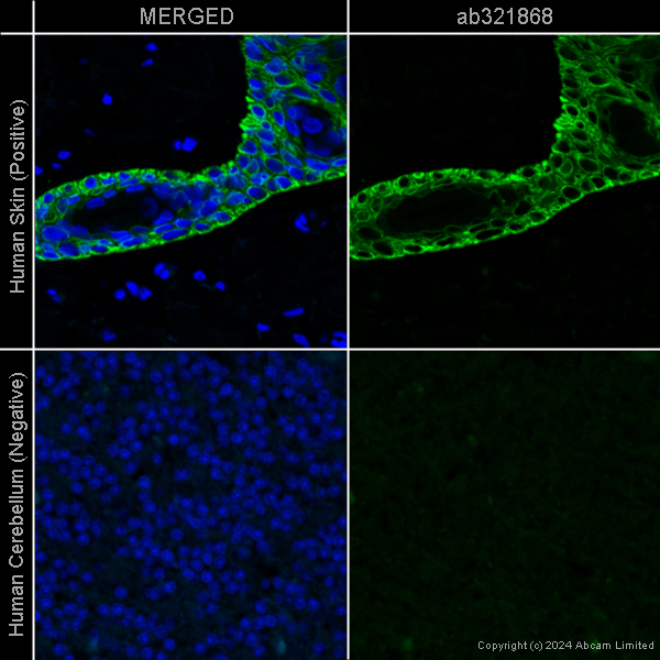 Immunohistochemistry (Formalin/PFA-fixed paraffin-embedded sections) - Donkey Anti-Goat IgG H&L (Alexa Fluor® 488) preadsorbed (AB150133)