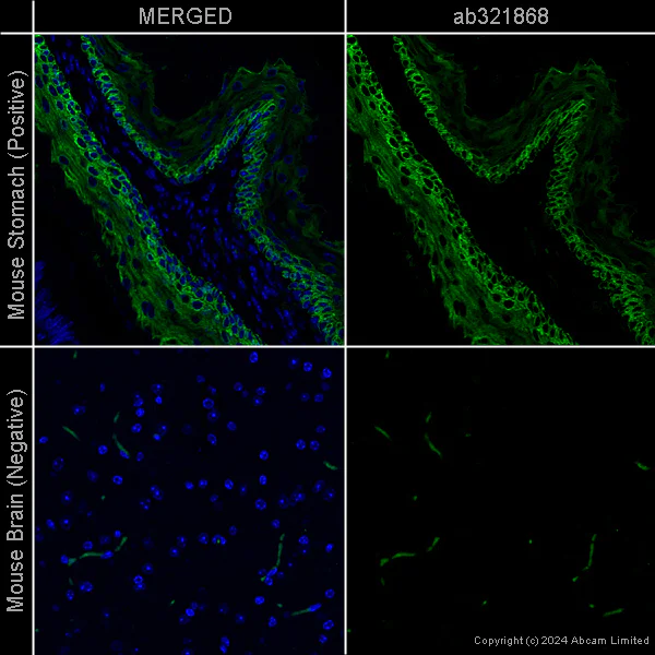 Immunohistochemistry (Formalin/PFA-fixed paraffin-embedded sections) - Donkey Anti-Goat IgG H&L (Alexa Fluor® 488) preadsorbed (AB150133)
