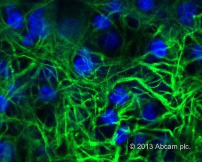 Immunocytochemistry/ Immunofluorescence - Donkey Anti-Goat IgG H&L (Alexa Fluor® 555) (AB150130)