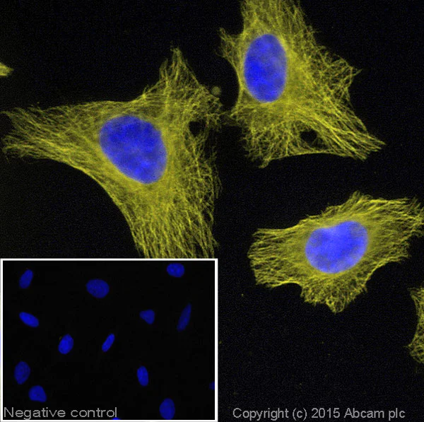 Immunocytochemistry/ Immunofluorescence - Donkey Anti-Goat IgG H&L (Alexa Fluor® 555) (AB150130)