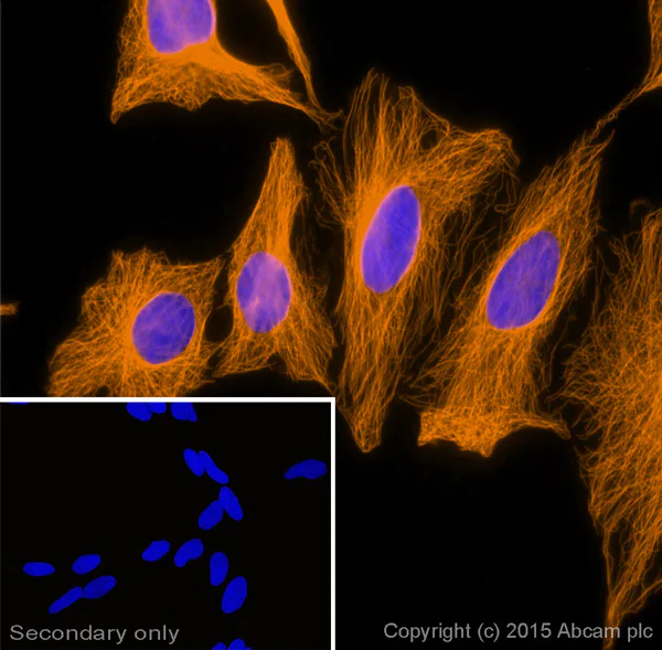 Immunocytochemistry/ Immunofluorescence - Donkey Anti-Goat IgG H&L (Alexa Fluor® 594) preadsorbed (AB150136)
