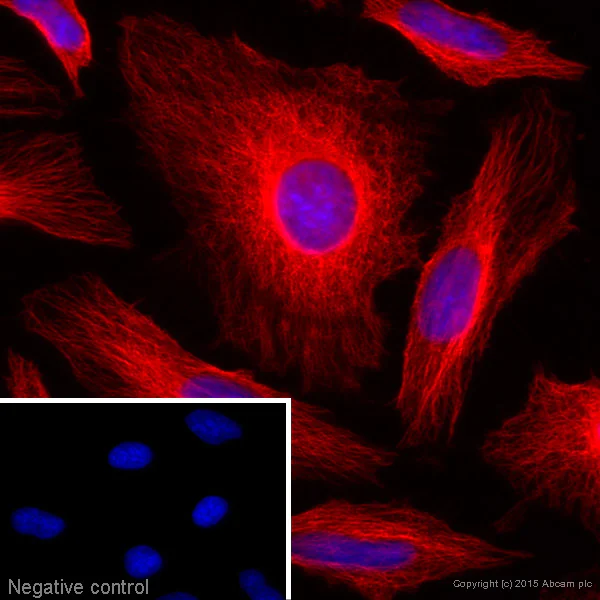 Immunocytochemistry/ Immunofluorescence - Donkey Anti-Goat IgG H&L (Alexa Fluor® 647) (AB150131)
