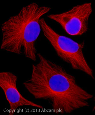 Immunocytochemistry/ Immunofluorescence - Donkey Anti-Goat IgG H&L (Alexa Fluor® 647) preadsorbed (AB150135)