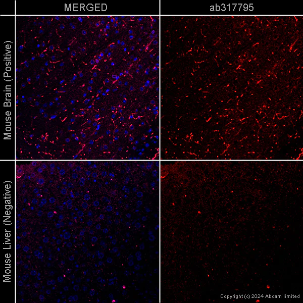 Immunohistochemistry (Formalin/PFA-fixed paraffin-embedded sections) - Donkey Anti-Goat IgG H&L (Alexa Fluor® 647) preadsorbed (AB150135)