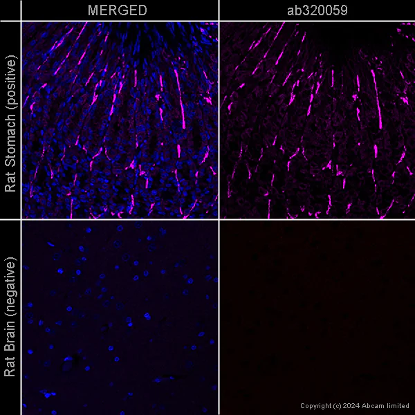 Immunohistochemistry (Formalin/PFA-fixed paraffin-embedded sections) - Donkey Anti-Goat IgG H&L (Alexa Fluor® 647) preadsorbed (AB150135)