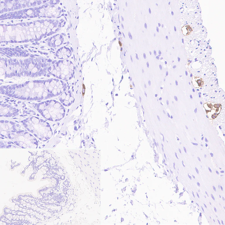 Immunohistochemistry (Formalin/PFA-fixed paraffin-embedded sections) - Donkey Anti-Goat IgG H&L (HRP) (AB205723)