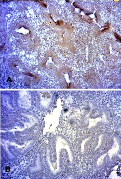Immunohistochemistry (Formalin/PFA-fixed paraffin-embedded sections) - Donkey Anti-Goat IgG H&L (HRP) (AB6885)