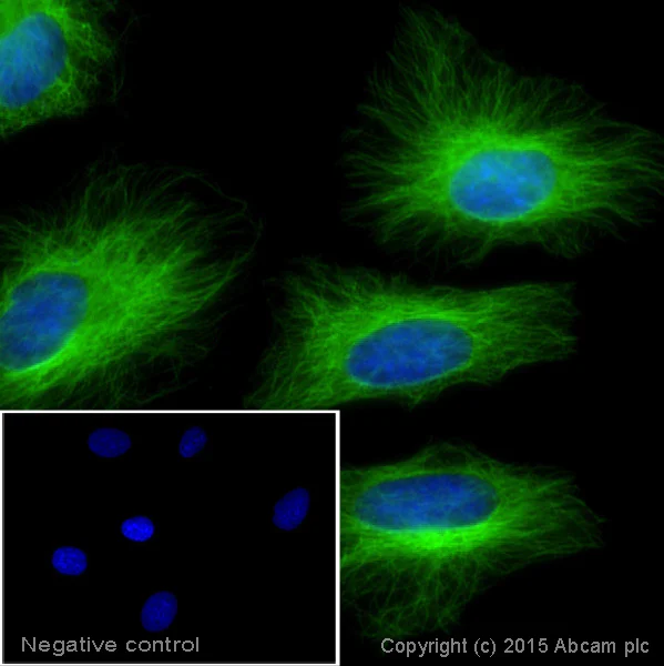 Donkey anti mouse IgG (Alexa Fluor® 488) secondary antibody