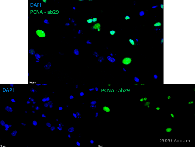 Immunohistochemistry (Formalin/PFA-fixed paraffin-embedded sections) - Donkey Anti-Mouse IgG H&L (Alexa Fluor® 488) preadsorbed (AB150109), expandable thumbnail