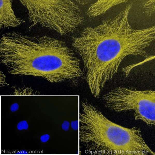 Immunocytochemistry/ Immunofluorescence - Donkey Anti-Mouse IgG H&L (Alexa Fluor® 555) (AB150106)