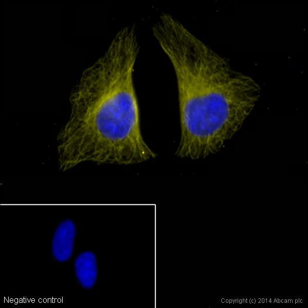 Immunocytochemistry/ Immunofluorescence - Donkey Anti-Mouse IgG H&L (Alexa Fluor® 555) preadsorbed (AB150110)