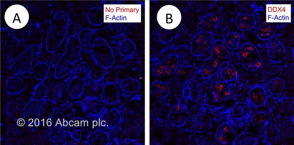 Immunohistochemistry (Frozen sections) - Donkey Anti-Mouse IgG H&L (Alexa Fluor® 555) preadsorbed (AB150110), expandable thumbnail