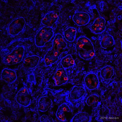 Immunohistochemistry (Frozen sections) - Donkey Anti-Mouse IgG H&L (Alexa Fluor® 555) preadsorbed (AB150110)