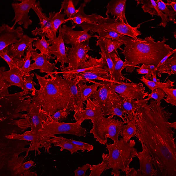Immunocytochemistry/ Immunofluorescence - Donkey Anti-Mouse IgG H&L (Alexa Fluor® 594) (AB150108)