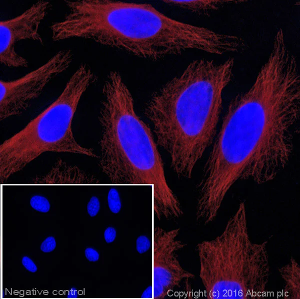 Immunocytochemistry/ Immunofluorescence - Donkey Anti-Mouse IgG H&L (Alexa Fluor® 647) (AB150107)
