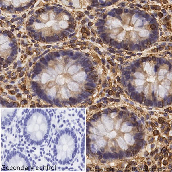 Immunohistochemistry (Formalin/PFA-fixed paraffin-embedded sections) - Donkey Anti-Mouse IgG H&L (Biotin) (AB208001)