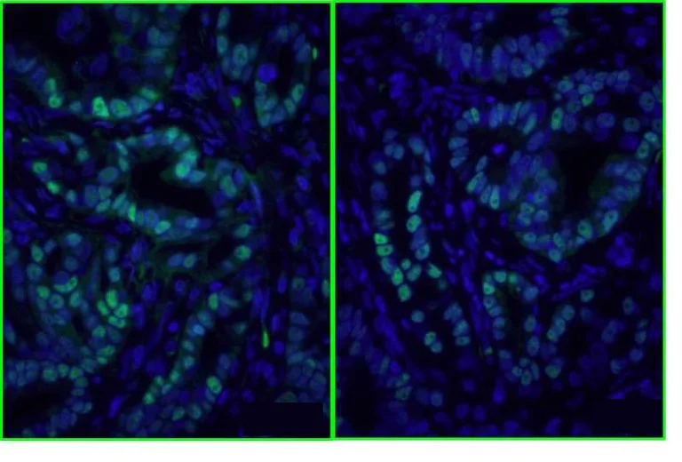 Immunohistochemistry (Formalin/PFA-fixed paraffin-embedded sections) - Donkey Anti-Mouse IgG H&L (DyLight® 488) preadsorbed (AB98794)