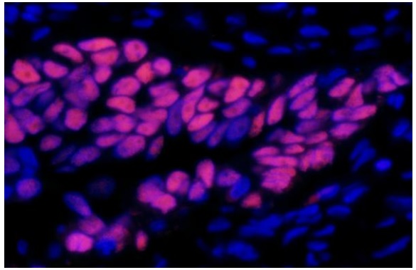 Immunohistochemistry (Formalin/PFA-fixed paraffin-embedded sections) - Donkey Anti-Mouse IgG H&L (DyLight® 550) (AB96876), expandable thumbnail