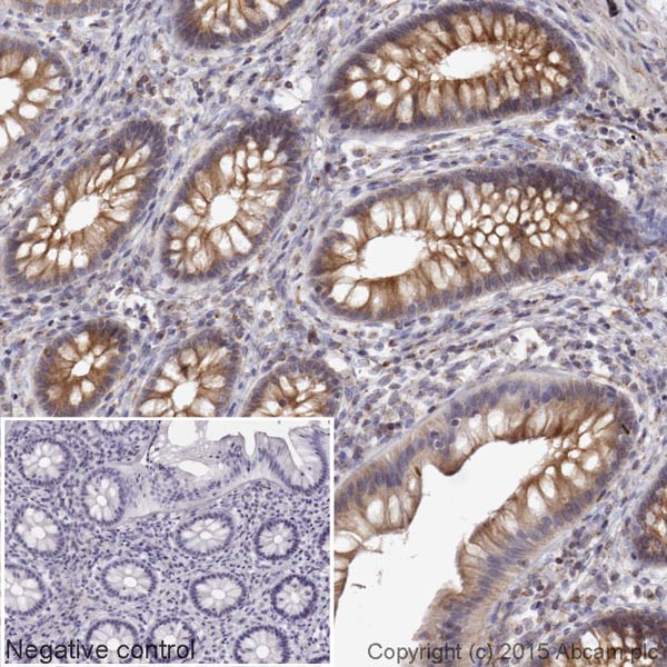 Immunohistochemistry (Formalin/PFA-fixed paraffin-embedded sections) - Donkey Anti-Mouse IgG H&L (HRP) (AB205724), expandable thumbnail